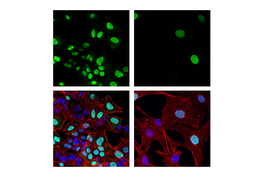  Image 35: Cell Cycle Phase Determination Antibody Sampler Kit