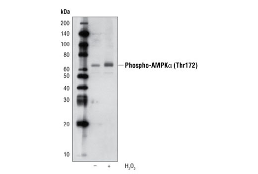 Western Blotting Image 1: Phospho-AMPKα (Thr172) (40H9) Rabbit mAb (Biotinylated)