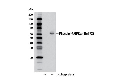 Western Blotting Image 2: Phospho-AMPKα (Thr172) (40H9) Rabbit mAb (Biotinylated)