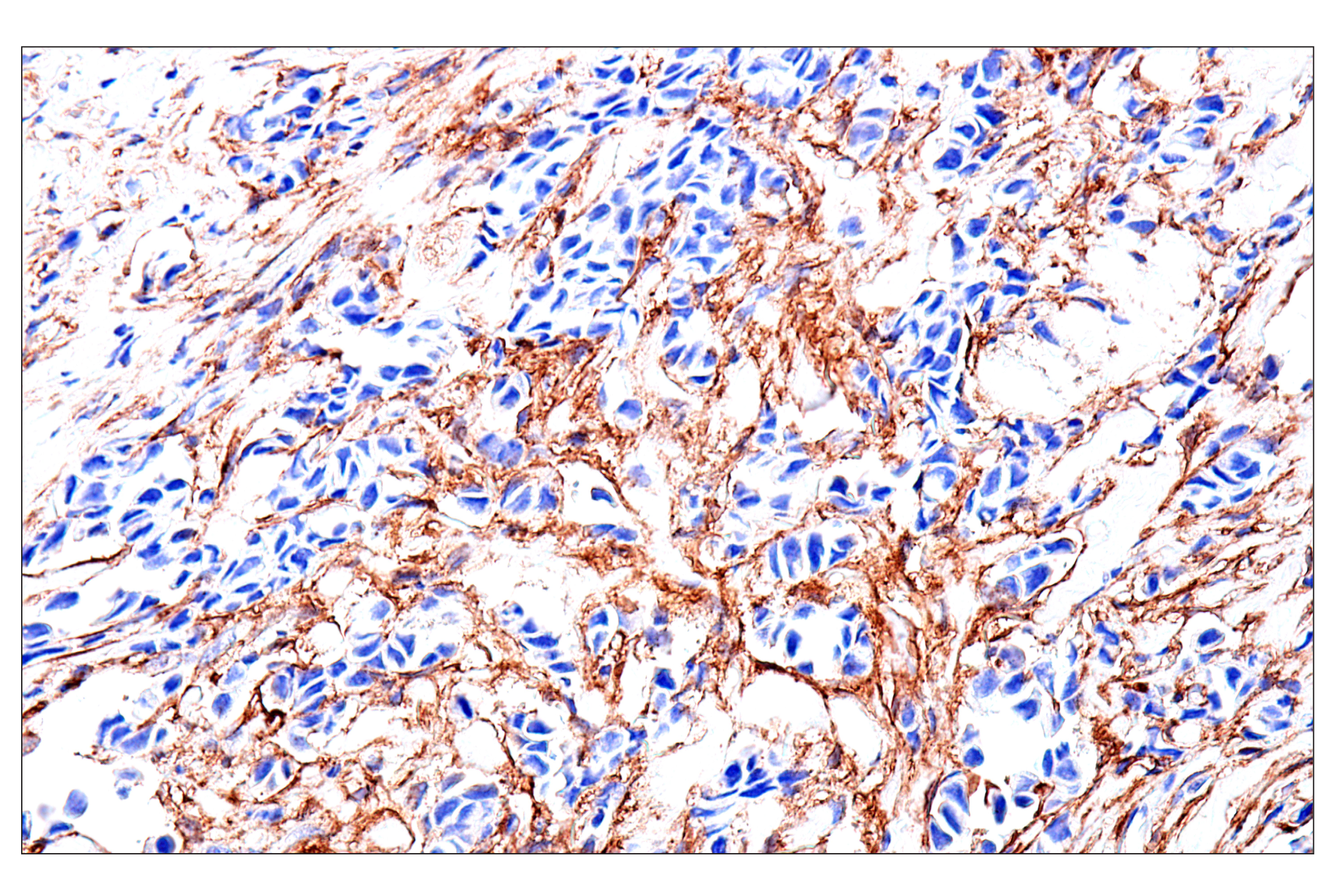 Immunohistochemistry Image 1: FAP (F1A4G) Rabbit mAb