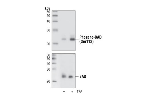  Image 13: Pro-Apoptosis Bcl-2 Family Antibody Sampler Kit