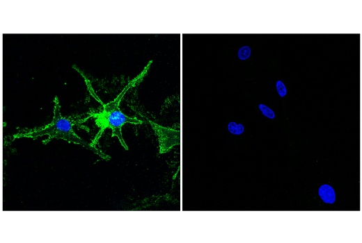 Immunofluorescence Image 1: CD81 (E2K9V) Rabbit mAb