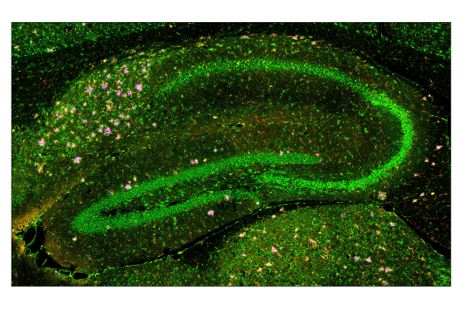 Immunofluorescence Image 2: Cathepsin D (E7Z4L) XP® Rabbit mAb (BSA and Azide Free)