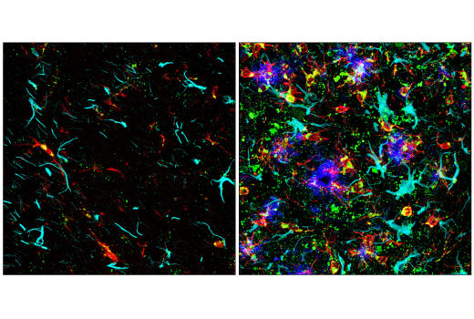 Immunofluorescence Image 3: Cathepsin D (E7Z4L) XP® Rabbit mAb (BSA and Azide Free)