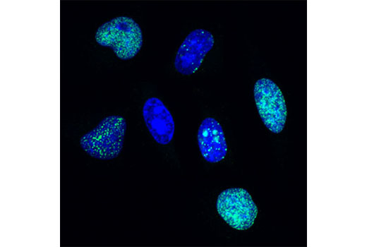 Immunofluorescence Image 1: BrdU (Bu20a) Mouse mAb