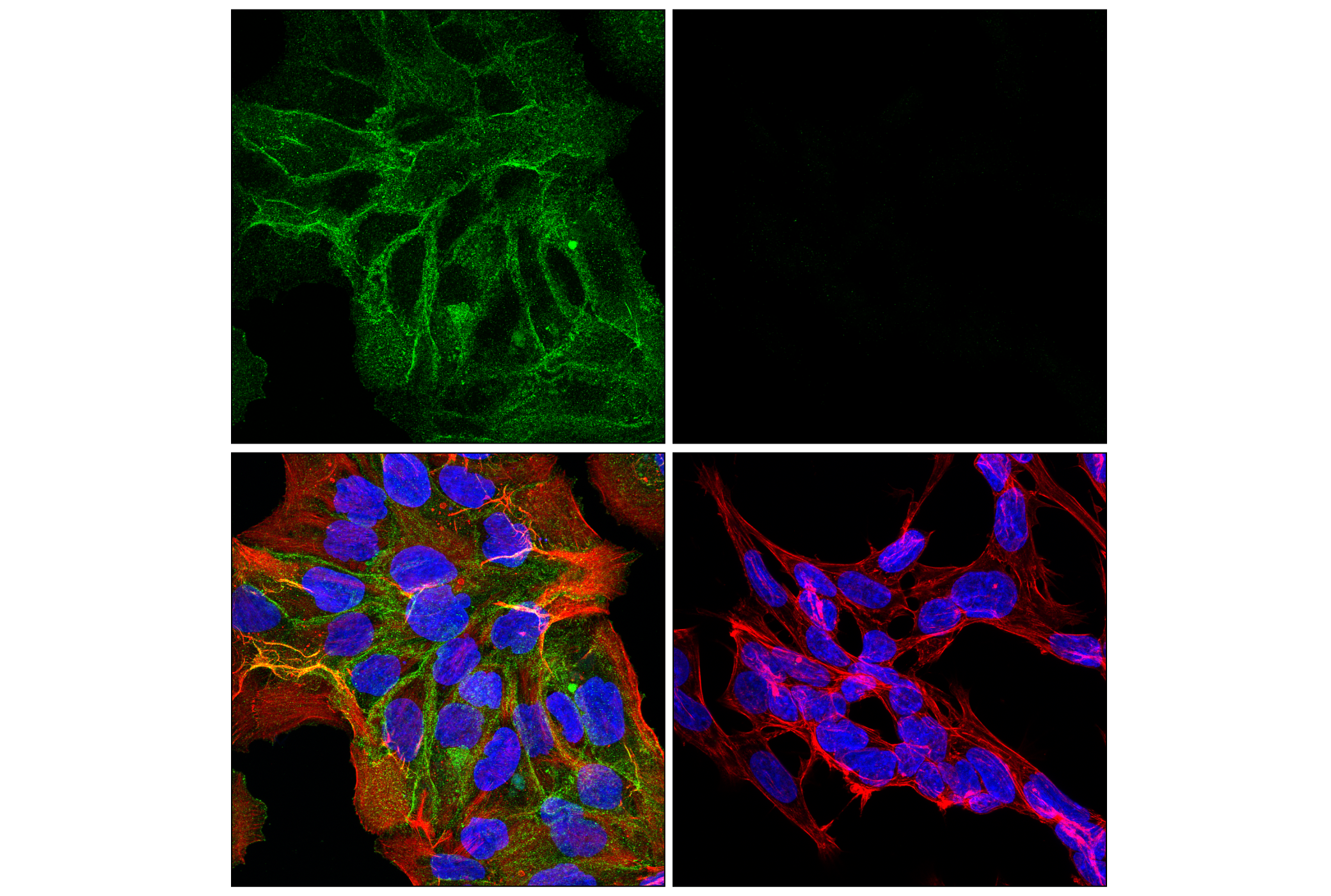 Immunofluorescence Image 1: Syndecan 1 (E7S6T) Rabbit mAb