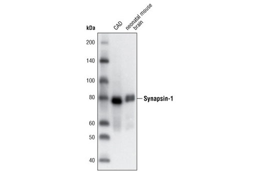  Image 8: ApoE Synaptic Formation and Signaling Pathway Antibody Sampler Kit