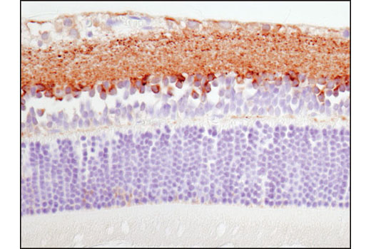  Image 31: ApoE Synaptic Formation and Signaling Pathway Antibody Sampler Kit