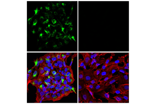 Immunofluorescence Image 2: Neurofilament-M (E7Y8W) Mouse mAb