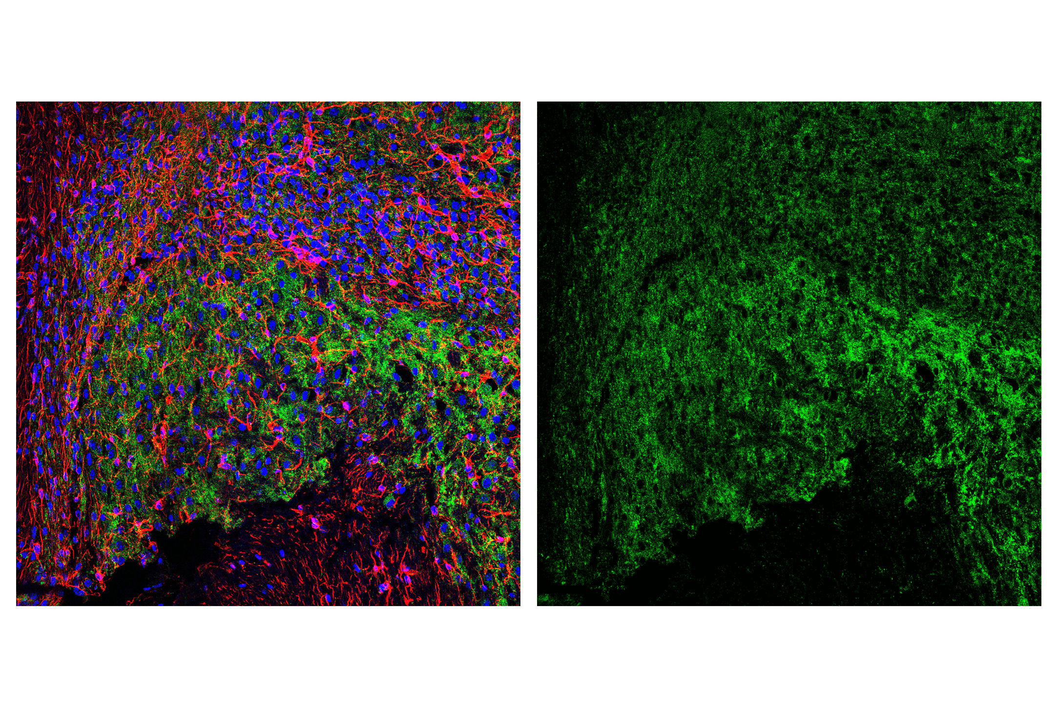 Immunofluorescence Image 2: AIF (D39D2) XP® Rabbit mAb