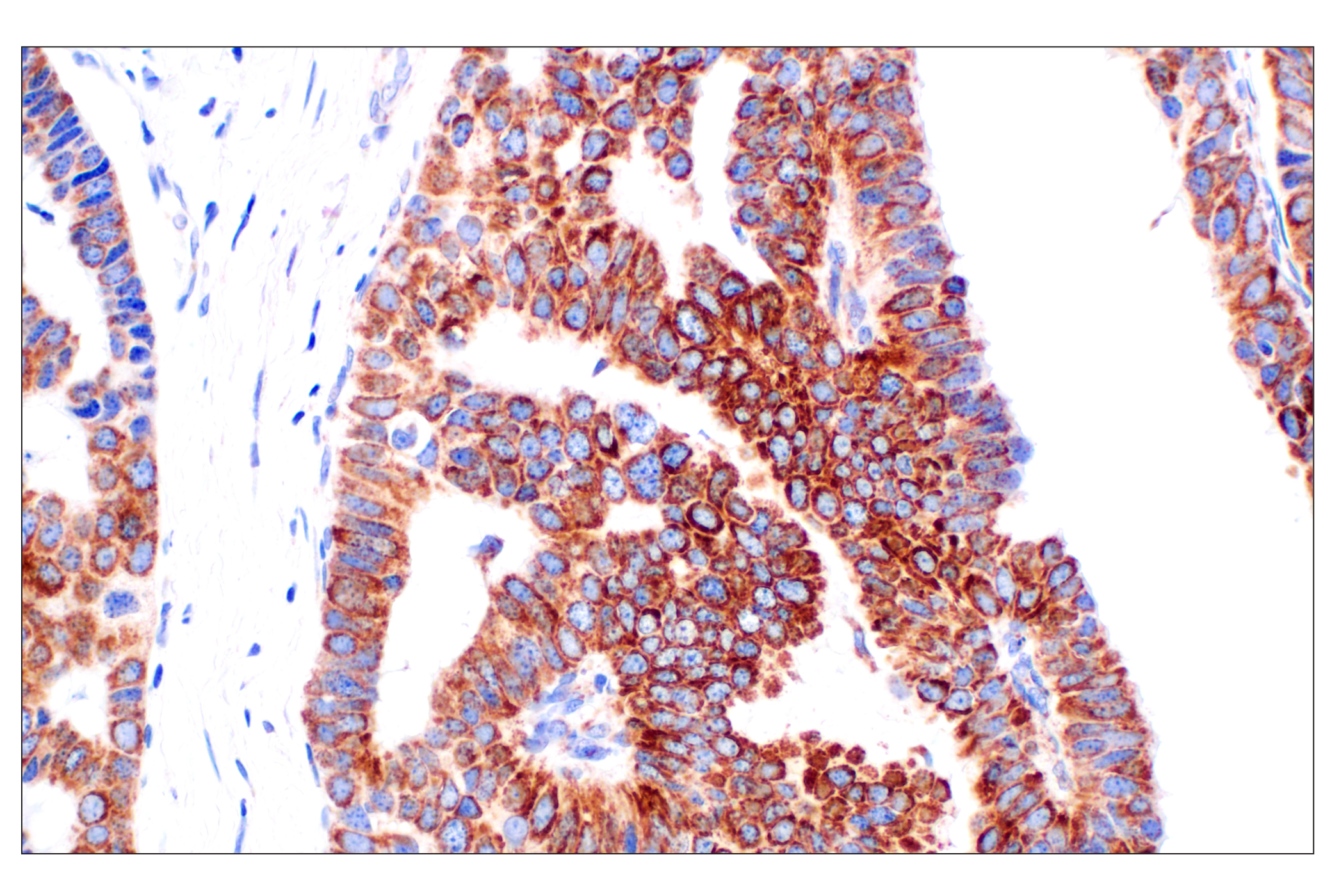  Image 33: Cell Fractionation Antibody Sampler Kit