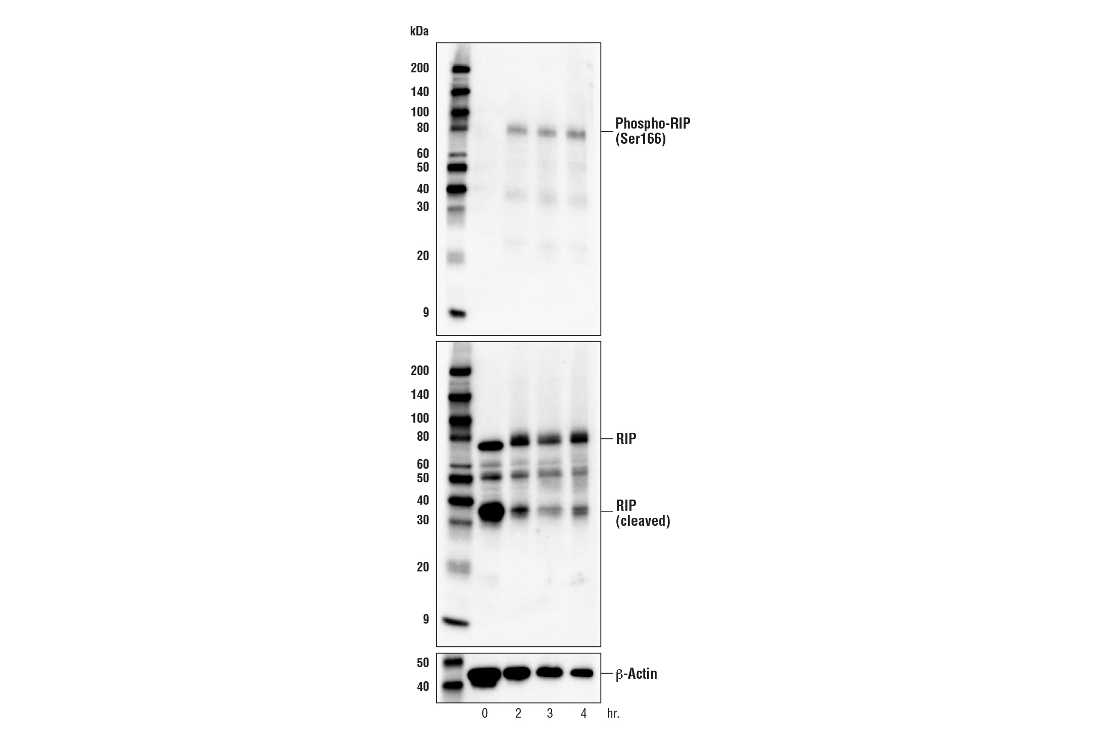  Image 17: Mouse Reactive Cell Death and Autophagy Antibody Sampler Kit