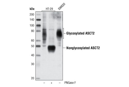 Western Blotting Image 1: ASCT2 (V501) Antibody