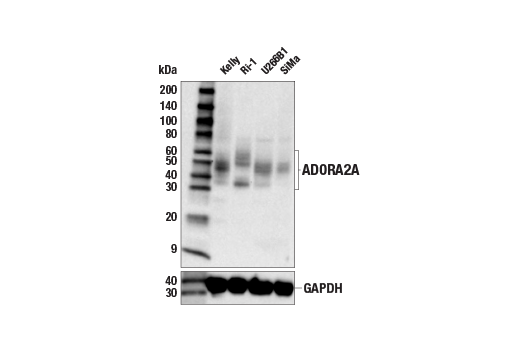 Western Blotting Image 3: ADORA2A/Adenosine Receptor A2a (E6M3W) Rabbit mAb
