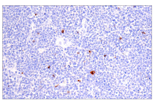 Immunohistochemistry Image 9: CTLA-4 (E2V1Z) Rabbit mAb