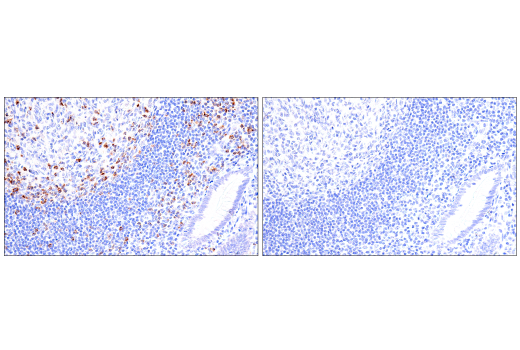Immunohistochemistry Image 13: CTLA-4 (E2V1Z) Rabbit mAb