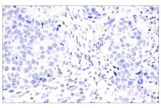 Immunohistochemistry Image 3: CTLA-4 (E2V1Z) Rabbit mAb