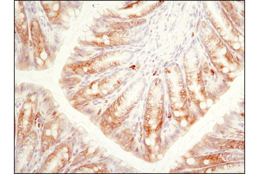  Image 19: p70 S6 Kinase Substrates Antibody Sampler Kit