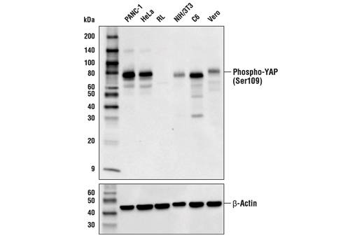  Image 11: PhosphoPlus® YAP (Ser109) Antibody Duet