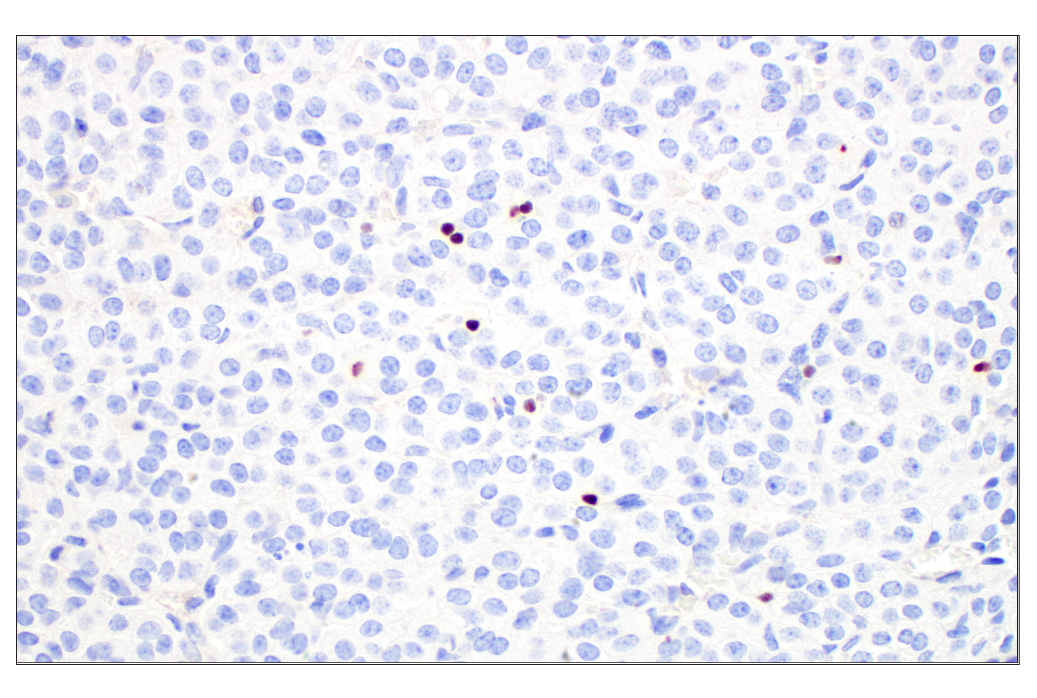 Immunohistochemistry Image 8: T-bet/TBX21 (E4I2K) Rabbit mAb (BSA and Azide Free)