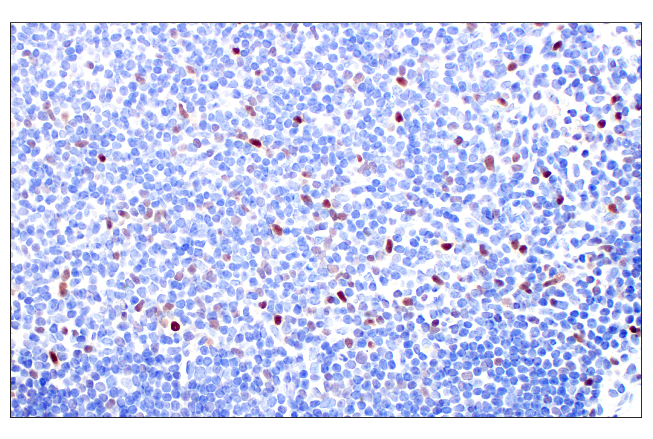 Immunohistochemistry Image 6: T-bet/TBX21 (E4I2K) Rabbit mAb (BSA and Azide Free)