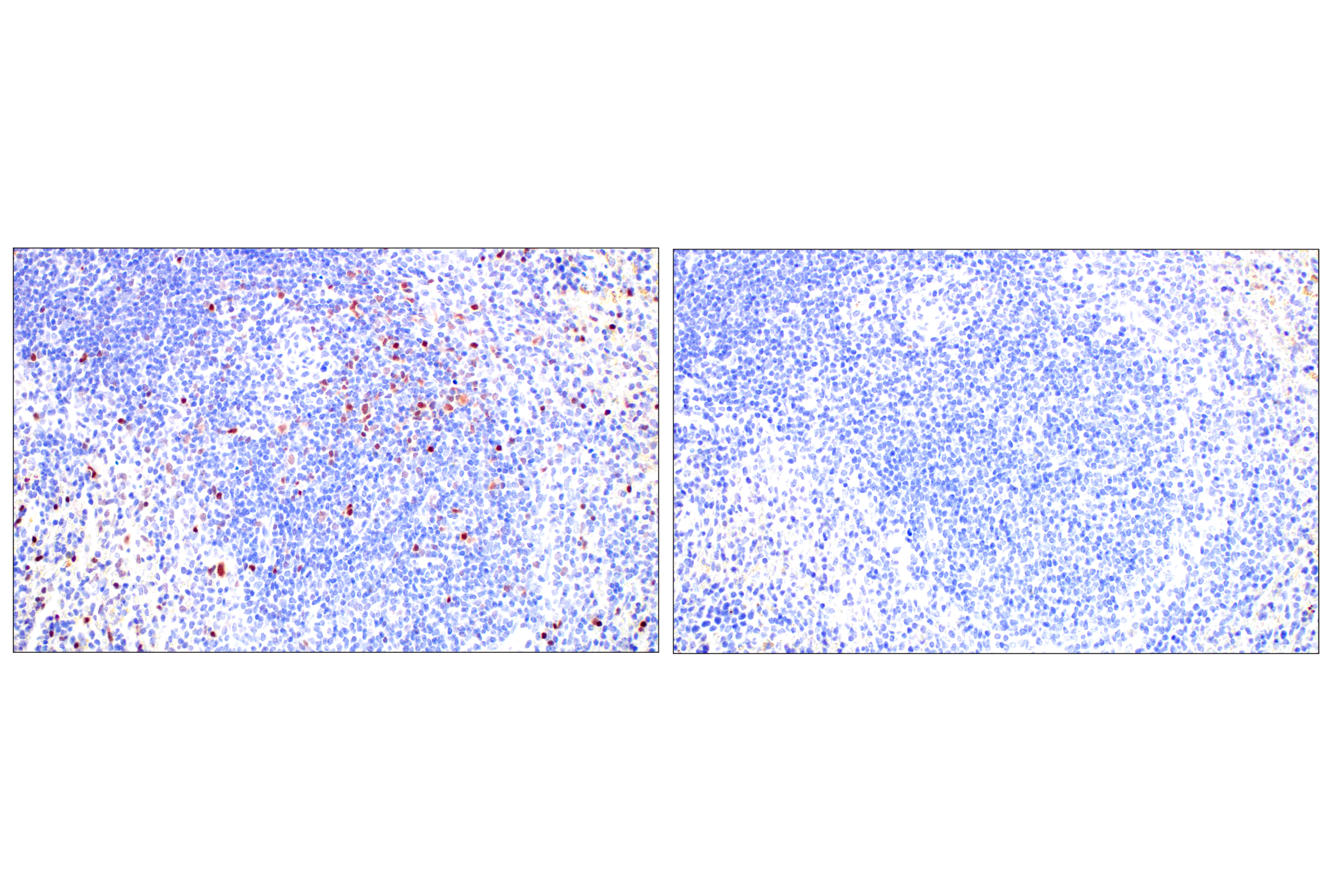 Immunohistochemistry Image 13: T-bet/TBX21 (E4I2K) Rabbit mAb (BSA and Azide Free)