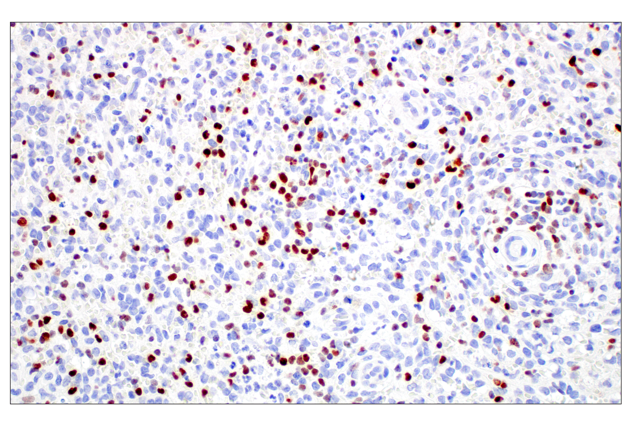 Immunohistochemistry Image 2: T-bet/TBX21 (E4I2K) Rabbit mAb (BSA and Azide Free)