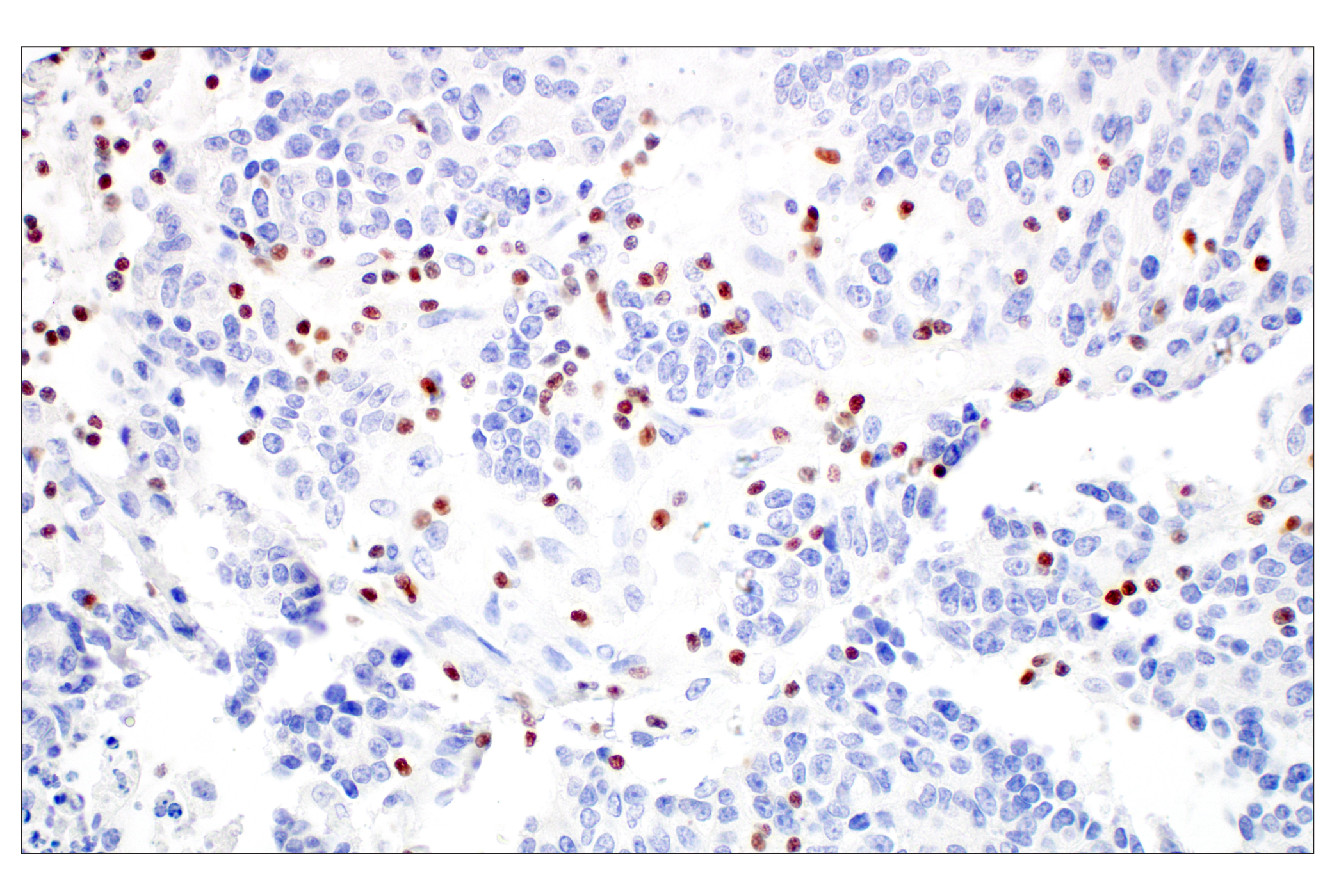 Immunohistochemistry Image 3: T-bet/TBX21 (E4I2K) Rabbit mAb (BSA and Azide Free)
