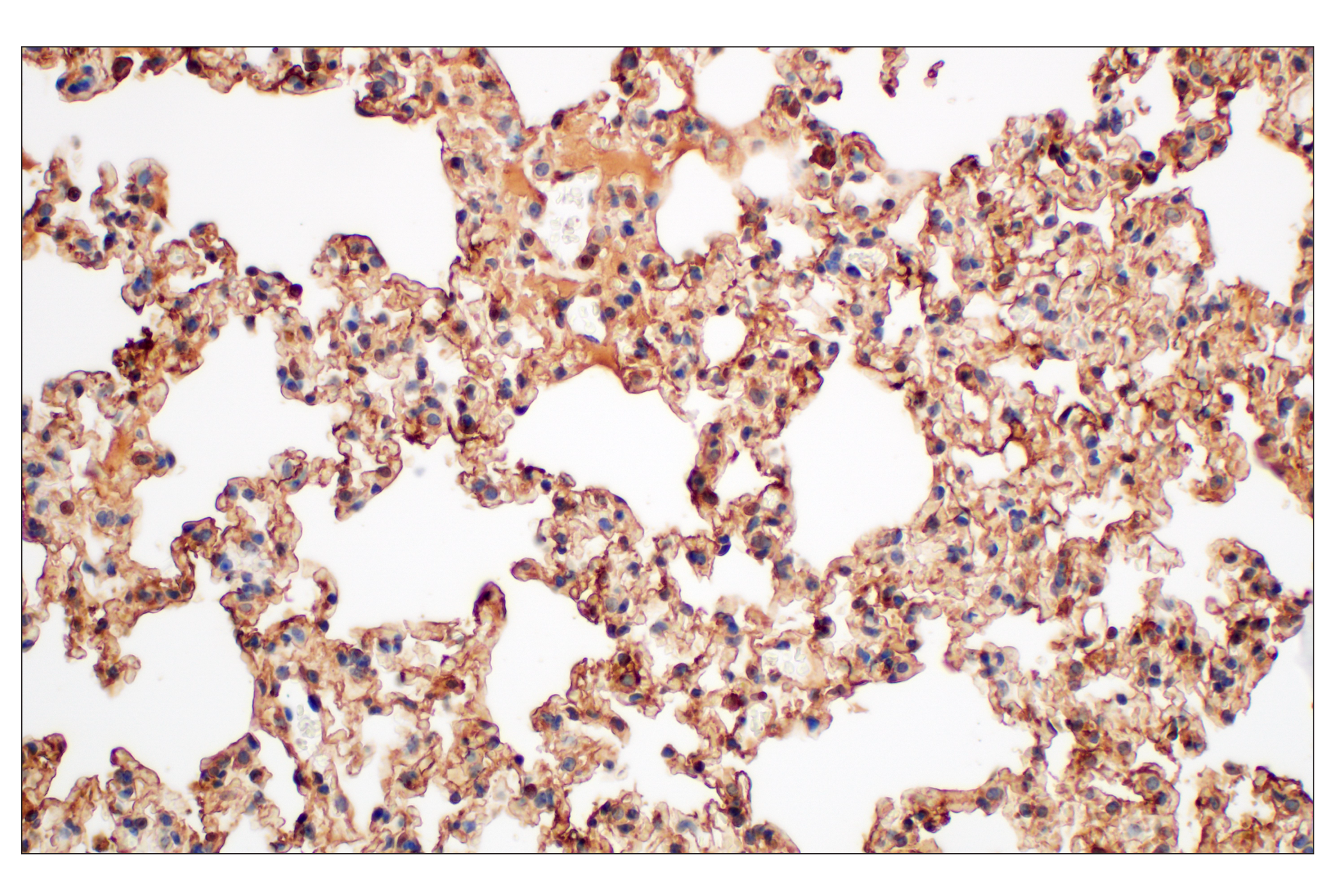 Immunohistochemistry Image 11: Annexin V (E3W8V) Rabbit mAb