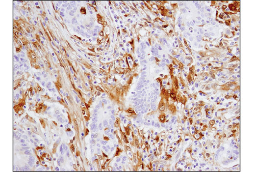Immunohistochemistry Image 2: Galectin-9 (D9R4A) XP® Rabbit mAb (BSA and Azide Free)
