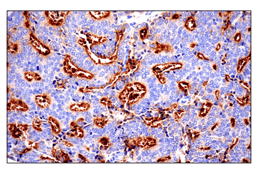 Immunohistochemistry Image 9: CD10/Neprilysin (E5P7S) Rabbit mAb (BSA and Azide Free)