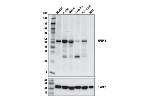  Image 11: ECM Profiling Antibody Sampler Kit
