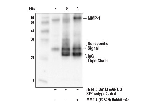  Image 20: ECM Profiling Antibody Sampler Kit