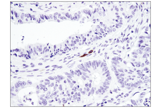 Immunohistochemistry Image 2: TNFRSF8/CD30 (E4L4I) XP® Rabbit mAb