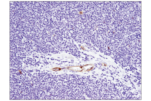 Immunohistochemistry Image 4: TNFRSF8/CD30 (E4L4I) XP® Rabbit mAb