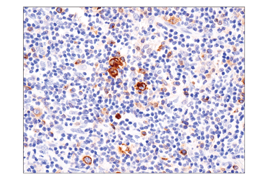 Immunohistochemistry Image 1: TNFRSF8/CD30 (E4L4I) XP® Rabbit mAb