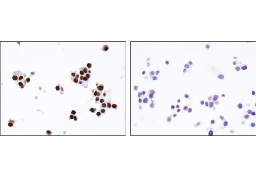  Image 27: Pancreatic Marker IHC Antibody Sampler Kit