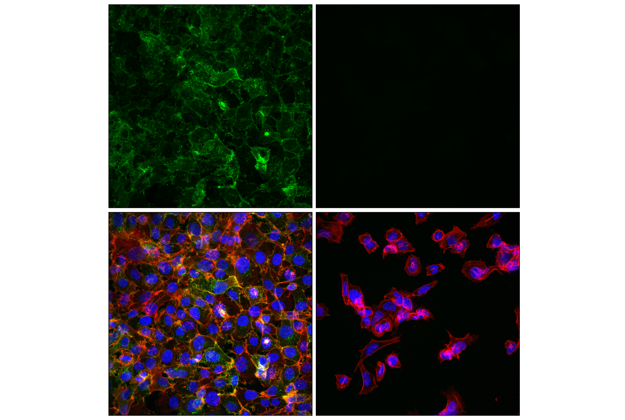 Immunofluorescence Image 1: Neuropilin-1 (E8L6E) Rabbit mAb