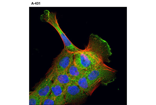 Immunofluorescence Image 1: CD2AP (A599) Antibody