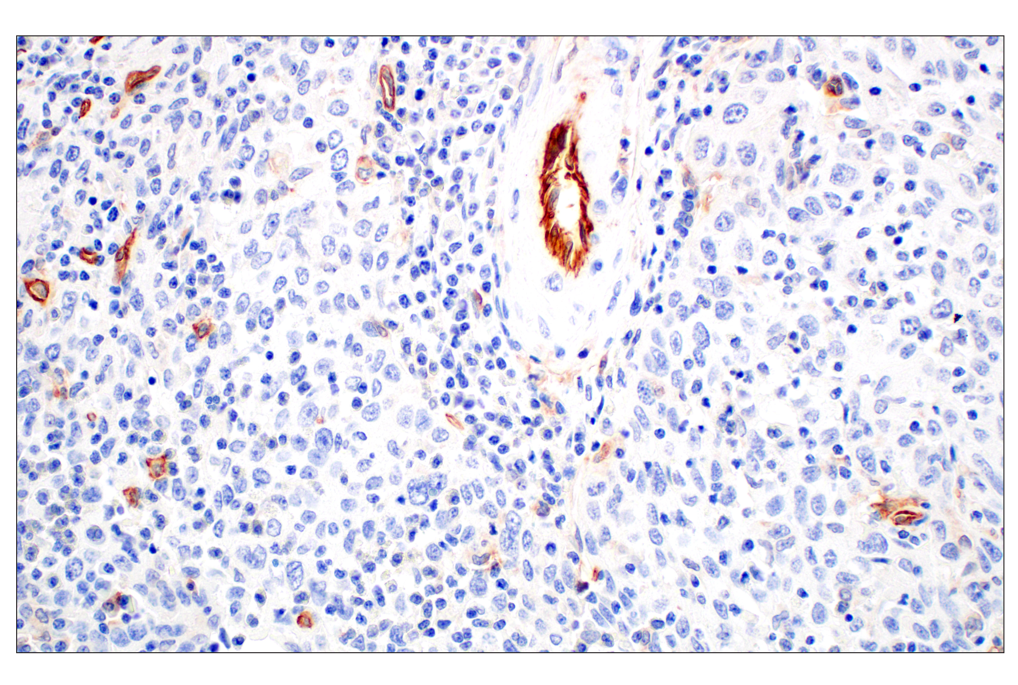 Immunohistochemistry Image 4: CD93/C1qR (E5H9B) Rabbit mAb