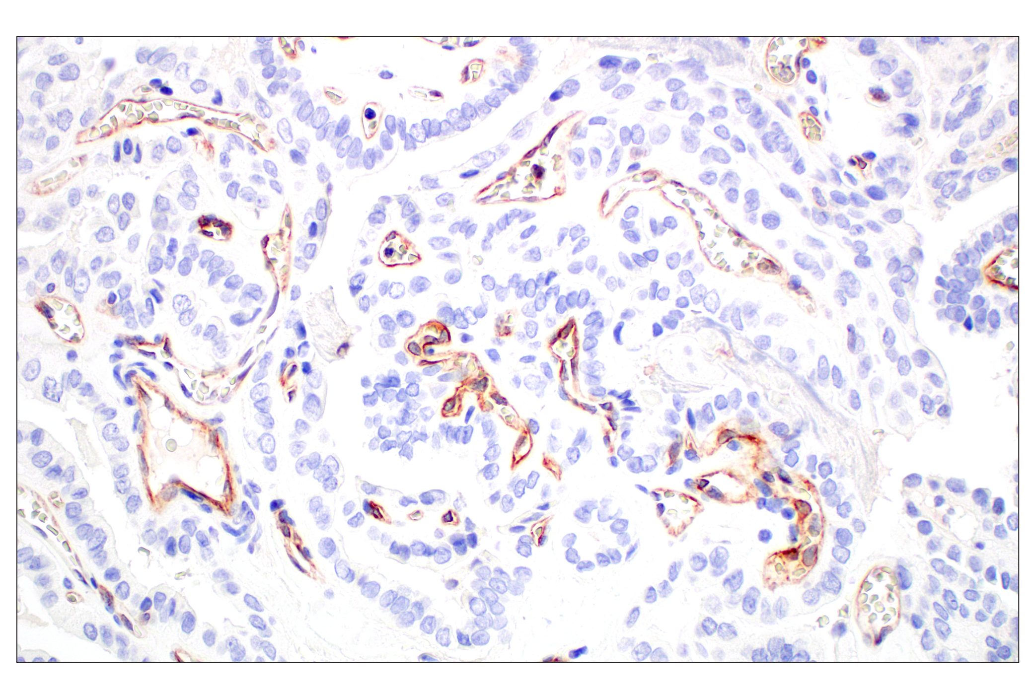 Immunohistochemistry Image 3: CD93/C1qR (E5H9B) Rabbit mAb
