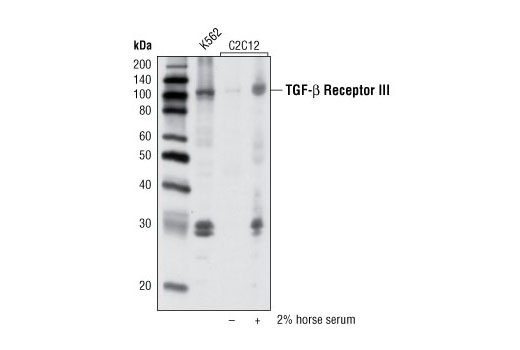 Western Blotting Image 1: TGF-beta Receptor III (D11G10) Rabbit mAb
