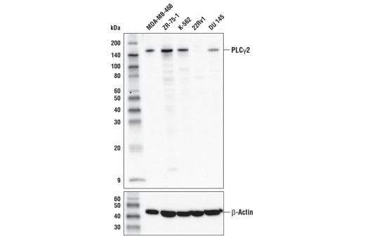 Image 7: PLCγ Antibody Sampler Kit