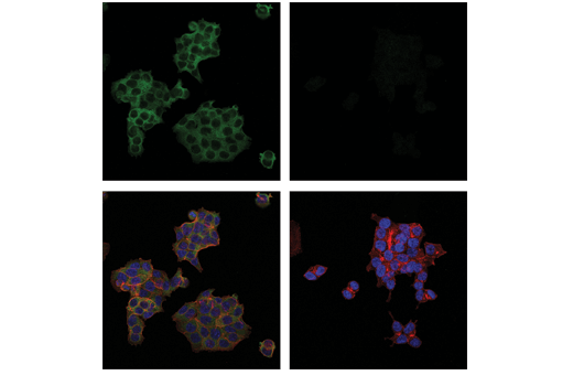  Image 6: PhosphoPlus® PLCγ2 (Tyr759) Antibody Duet