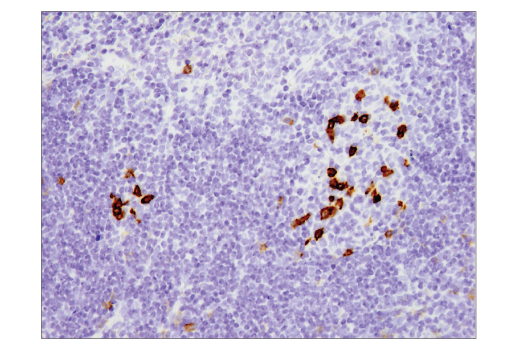 Immunohistochemistry Image 3: PD-1 (Intracellular Domain) (D7D5W) XP® Rabbit mAb (BSA and Azide Free)