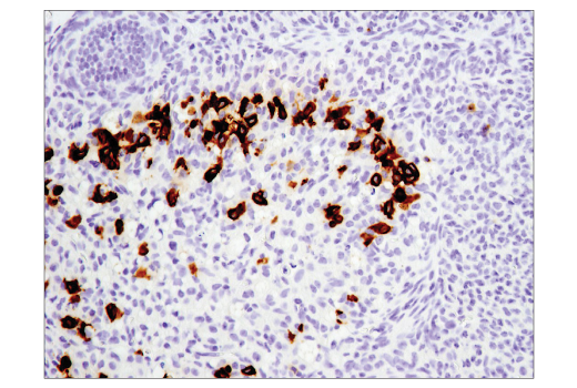 Immunohistochemistry Image 5: PD-1 (Intracellular Domain) (D7D5W) XP® Rabbit mAb (BSA and Azide Free)