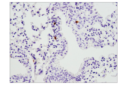 Immunohistochemistry Image 4: PD-1 (Intracellular Domain) (D7D5W) XP® Rabbit mAb (BSA and Azide Free)
