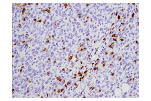 Immunohistochemistry Image 1: PD-1 (Intracellular Domain) (D7D5W) XP® Rabbit mAb (BSA and Azide Free)