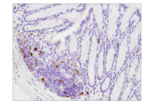 Immunohistochemistry Image 2: PD-1 (Intracellular Domain) (D7D5W) XP® Rabbit mAb (BSA and Azide Free)