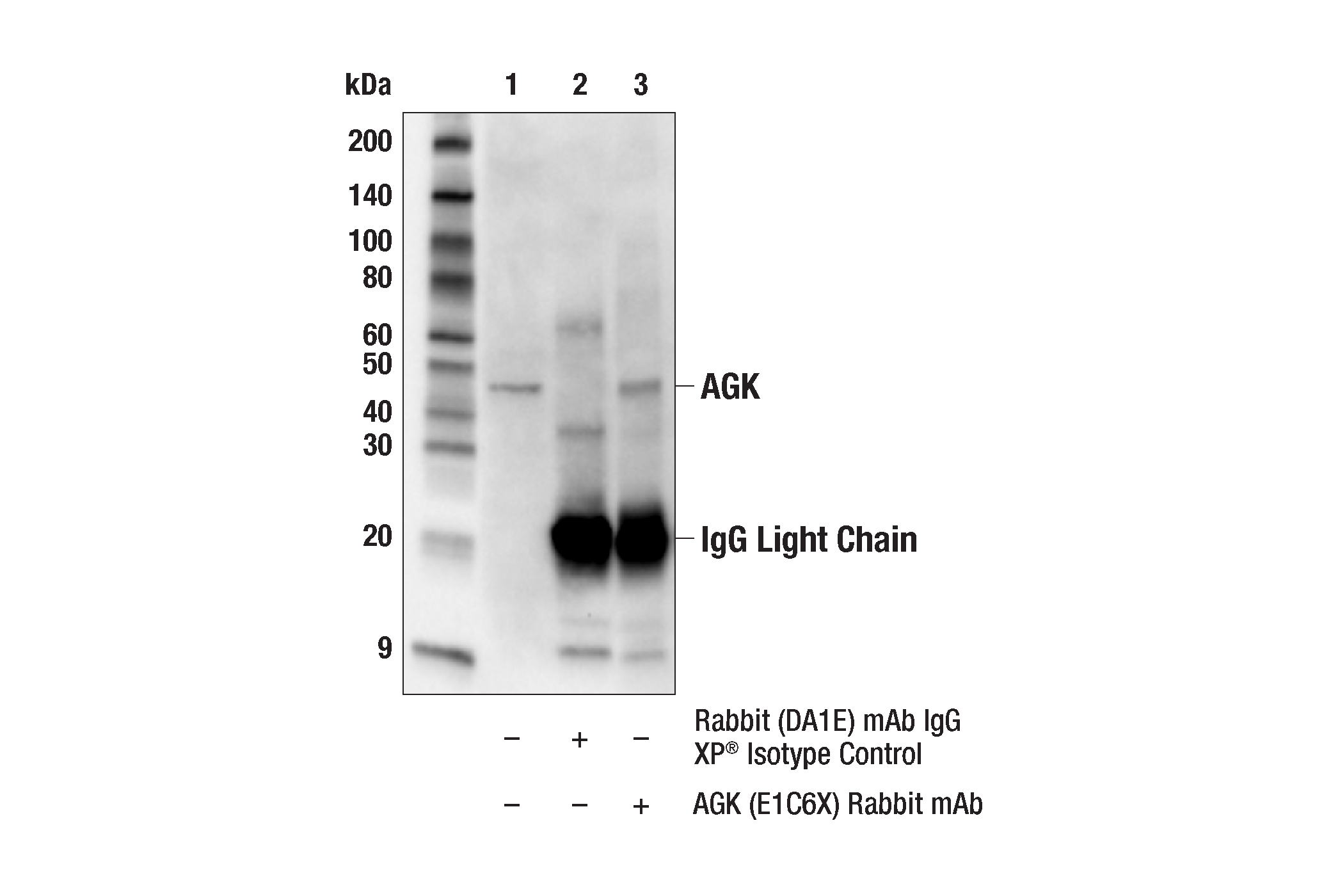 Immunoprecipitation Image 1: AGK (E1C6X) Rabbit mAb
